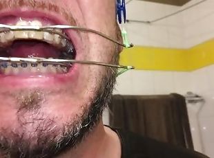 Horny deepthroat full of spit with braces and double headgear