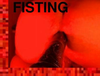 extremo, fisting, grande, anal, gay, fudendo, bizarro-kinky, máquinas, dildo, fetiche